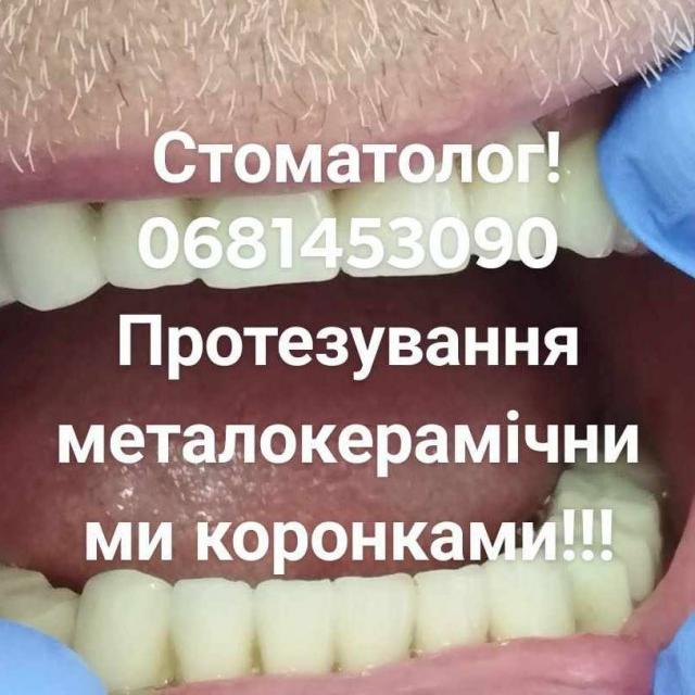 Стоматолог в КиєвіГарна якість і помірні ціни